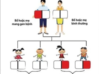 Thalassemia Thalassemia thể nặng Thalassemia thể nhẹ